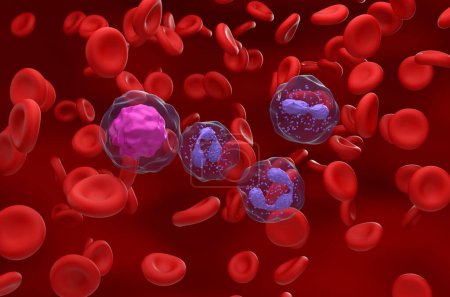 Téléchargez les photos : Rapport neutrophiles-lymphocytes (NLR) élevé dans l'inflammation - vue isométrique Illustration 3D - en image libre de droit