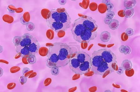 Téléchargez les photos : Lymphome folliculaire (FL) cellules dans le flux sanguin - vue isométrique illustration 3d - en image libre de droit
