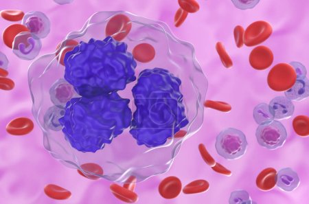 Foto de Linfoma folicular (FL) células en el flujo sanguíneo - vista de cerca 3d ilustración - Imagen libre de derechos