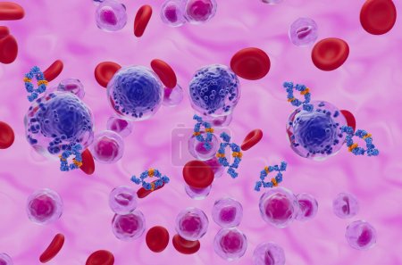 Foto de Tratamiento de anticuerpos monoclonales en la leucemia mieloide aguda (LMA) - vista isométrica 3d ilustración - Imagen libre de derechos