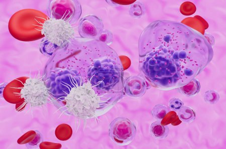 Foto de Célula dendrítica reconocer Mieloma múltiple (MM) celda - vista de cerca 3d ilustración - Imagen libre de derechos