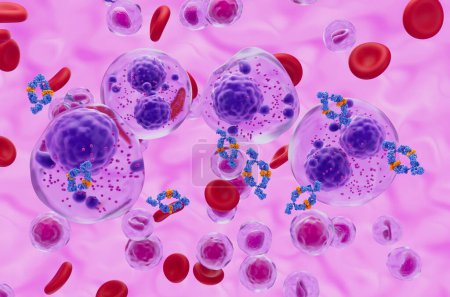 Téléchargez les photos : Traitement monoclonal des anticorps dans le myélome multiple (MM) - vue isométrique Illustration 3d - en image libre de droit