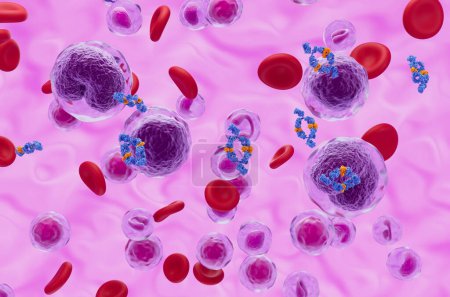 Téléchargez les photos : Traitement monoclonal des anticorps dans le lymphome non hodgkinien (LNH) - vue isométrique illustration 3d - en image libre de droit