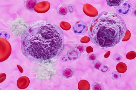 Foto de Las células dendríticas reconocen el linfoma no-hodgkin (LNH) - vista de cerca ilustración 3d - Imagen libre de derechos