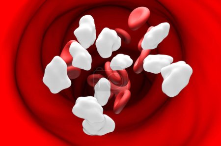 Hoher Glukosespiegel im Blut - Schnittansicht 3D-Illustration