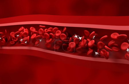 Reduced platelet (thrombocytes) count in Immune thrombocytopenic purpura (ITP) - isometric view 3d illustration