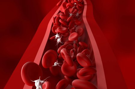 Téléchargez les photos : Diminution du nombre de plaquettes (thrombocytes) dans le purpura thrombopénique immunologique (PTI) - illustration en 3D vue de face - en image libre de droit