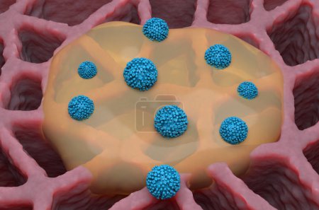 Virus de la influenza (gripe) y mucosidad en el pulmón - vista isométrica ilustración 3D