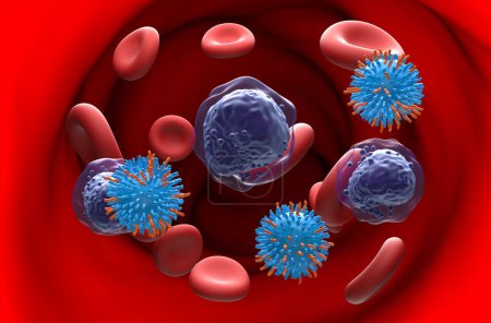 Foto de Terapia con células T CAR en la leucemia mieloide aguda (LMA) - ver ilustración en 3D - Imagen libre de derechos