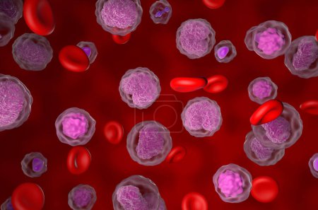Foto de Non-hodgkin lymphoma (NHL) cells in the blood flow - isometric view 3d illustration - Imagen libre de derechos