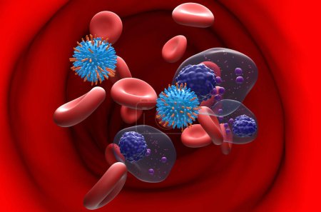 Foto de Terapia con células T CAR en mieloma múltiple (MM) - ver sección ilustración 3D - Imagen libre de derechos