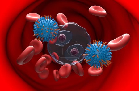 Foto de Terapia con células T de CAR en el linfoma de Hodgkin (LH) - ver ilustración en 3D - Imagen libre de derechos