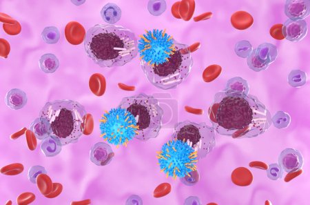 Thérapie par cellules T CAR dans la leucémie lymphocytaire chronique (LLC) - vue isométrique Illustration 3d