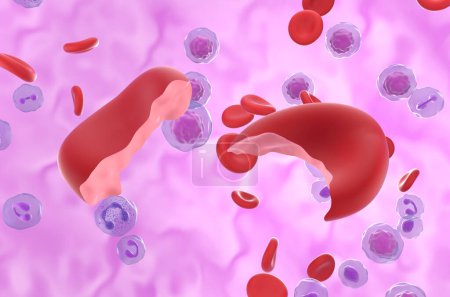 Téléchargez les photos : Cellules de l'anémie hémolytique (HA) dans le flux sanguin - vue rapprochée Illustration 3D - en image libre de droit