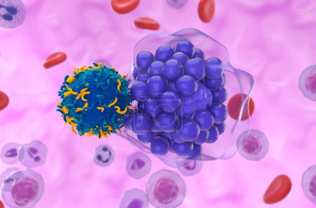 CAR T cell therapy in Diffuse large B-cell lymphoma (DLBCL) - closeup view 3d illustration