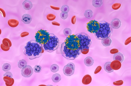 Thérapie par cellules T CAR dans le lymphome diffus à grandes cellules B (DLBCL) - vue isométrique illustration 3d