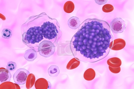 Leucémie à plasmocytes (LPC) - vue rapprochée Illustration 3d