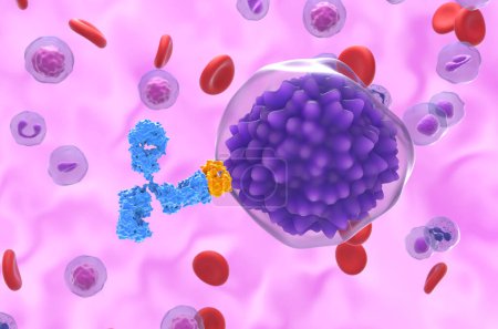 Monoklonale Antikörperbehandlung bei Plasmazellen-Leukämie (PCL) - Nahaufnahme 3D-Illustration