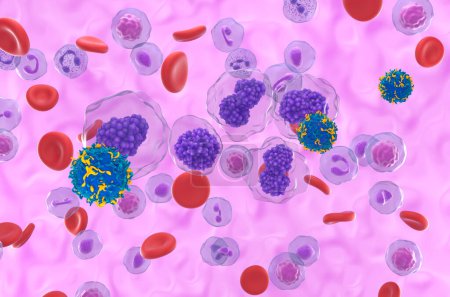 Terapia con células T CAR en la leucemia de células plasmáticas (LCP) - vista isométrica ilustración 3D