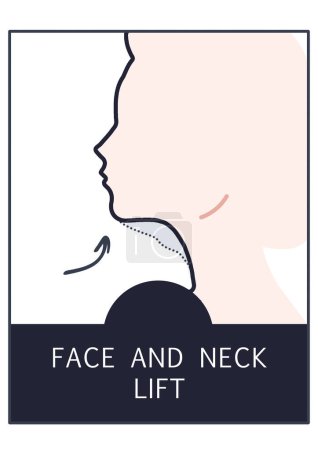 Icono de cirugía estética de elevación de cara y cuello, Arte de línea de procedimiento de implante de seno, Clínica de cirujano plástico, Ilustración de cirugía estética 