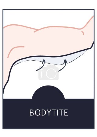 Icono de cirugía estética BodyTite, Arte de línea de procedimiento de piel caída, Clínica de cirujano plástico, Apretamiento de brazos, Liposucción de pérdida de peso, Ilustración de cirugía estética