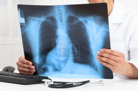 Foto de Man Doctor Looking at X-Ray Radiography in patient's Room with lung disease, long COVID-19 at hospital - Imagen libre de derechos