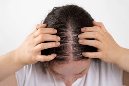 Téléchargez les photos : Close-up of woman controls hair loss and little volume with fine hair against a white background because of the sun - en image libre de droit