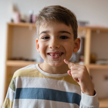 Foto de Un niño caucásico niño en casa con los dientes de leche primaria deciduo perdido diente caído cayó creciendo espacio de copia concepto - Imagen libre de derechos