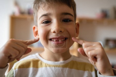 Foto de Un niño caucásico niño en casa con los dientes de leche primaria deciduo perdido diente caído cayó creciendo espacio de copia concepto - Imagen libre de derechos