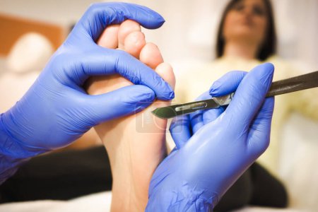 Photo for Foot treatment in SPA salon. Medical pedicure procedure using special instrument with blade knife holder. Professional pedicure using dieffenbach scalpel.. Podiatrist. - Royalty Free Image