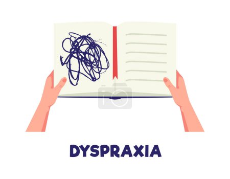 Illustration for Dyspraxia, apraxia poster. ADHD people concept. Difficulty learning and writing. There are dizzy squiggles drawn in the open notebook in hands. Vector illustration on white background - Royalty Free Image
