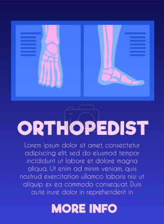 Illustration for Orthopedist landing page template. X-ray pictures with human leg bones and text space below. Flat vector illustration design for poster, banner, web, app. - Royalty Free Image