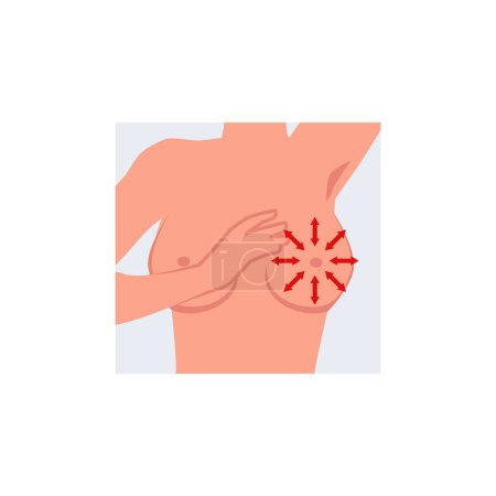 Ilustración de Guía ilustrativa para la técnica de autoexamen del cáncer de mama con flechas direccionales en el área torácica - Imagen libre de derechos