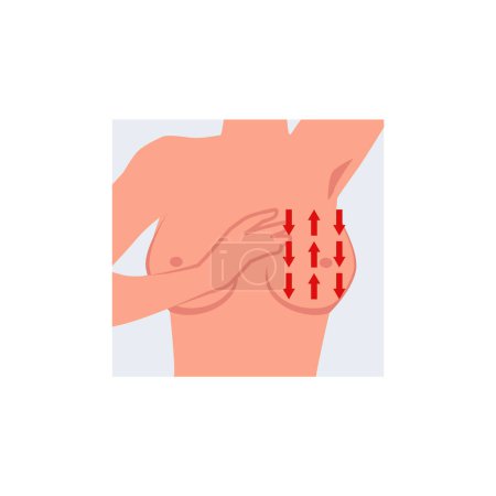 Vektor-Illustration zur Demonstration der vertikalen Selbstuntersuchung der Brust mit roten Pfeilen auf dem Oberkörper