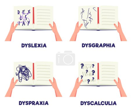 Set of hands holding opened notebooks flat style, vector illustration isolated on white background. Decorative design elements collection, learning difficulties, dyslexia and dysgraphia