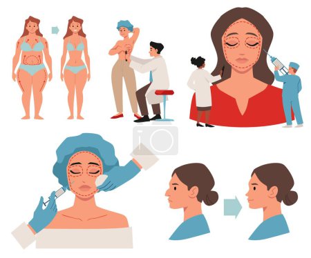 Illustration for Set of people with plastic surgery flat style, vector illustration isolated on white background. Decorative design elements collection, doctors and patients, health and beauty - Royalty Free Image