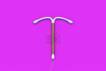 Dispositivo anticonceptivo sobre fondo rosa. Anticonceptivo femenino en forma de T. Dispositivo intrauterino con bobina. Educación sexual. Método de prevención y anticoncepción. Embarazo no deseado. Vista superior. 3d renderizar