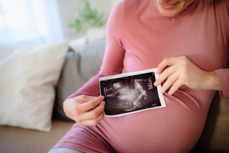 Photo for Pregnant woman showing ultrasound photo of a baby. - Royalty Free Image
