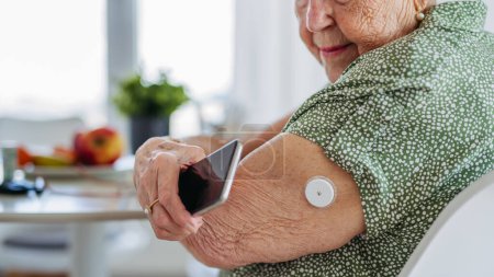 Téléchargez les photos : Patient âgé diabétique vérifiant le taux de glucose sanguin à la maison à l'aide d'un glucomètre continu. Femme âgée connectant sa MGM avec un téléphone intelligent pour voir ses niveaux de sucre dans le sang en temps réel. - en image libre de droit