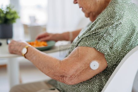 Großaufnahme eines kontinuierlichen Glukosemessgeräts am Oberarm einer älteren Frau. Diabetischer Senior-Patient mit kontinuierlichem Glukosemesser zur Kontrolle des Blutzuckerspiegels zu Hause. CGM-Gerät macht Senioren das Leben schwer