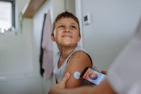 Junge mit Diabetes überprüfen den Blutzuckerspiegel zu Hause mit einem kontinuierlichen Blutzuckermessgerät. Die Mutter des Jungen verbindet sein CGM mit einem Smartphone, um seinen Blutzuckerspiegel in Echtzeit zu überwachen.