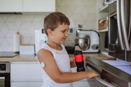 Photo for Diabetic boy with a continuous glucose monitor cant drink sweetened soda, sugar drink. - Royalty Free Image