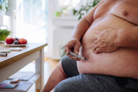 Foto de Hombre con sobrepeso y diabetes inyectándose insulina en el abdomen. Primer plano del hombre con diabetes tipo 1 que toma insulina con pluma de insulina. - Imagen libre de derechos