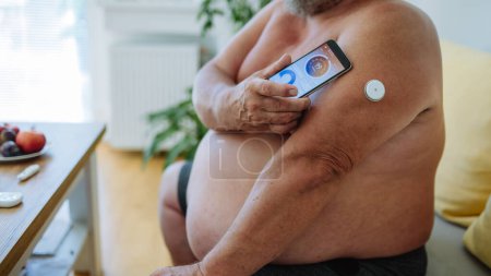 Téléchargez les photos : Homme diabétique en surpoids connectant sa MPC à un smartphone pour surveiller son taux de sucre dans le sang en temps réel. Gros plan de l'homme diabétique à l'aide d'un glucomètre continu pour vérifier la glycémie. - en image libre de droit