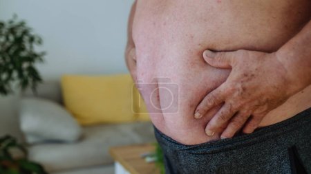 Foto de Primer plano de un hombre obeso sosteniendo su barriga. Abdomen obeso sobresaliente, peligros de la grasa abdominal. - Imagen libre de derechos