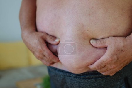 Foto de Primer plano de un hombre obeso sosteniendo su barriga. Abdomen obeso sobresaliente, peligros de la grasa abdominal. - Imagen libre de derechos