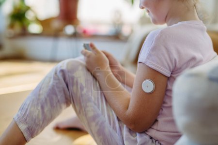 Diabetic girl with continuous glucose monitor on arm. The CGM device makes the life of the schoolgirl easier, helping manage his illness and focus on other activities.