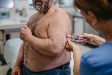 Foto de Médico femenino midiendo la grasa corporal de un paciente con sobrepeso usando una pinza. Obesidad que afecta la salud de los hombres de mediana edad. Concepto de riesgos para la salud de sobrepeso y obesidad. - Imagen libre de derechos