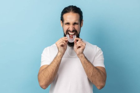 Photo for Portrait of man with beard wearing white T-shirt putting dental aligner retainer, dental clinic for beautiful teeth, treatment course concept. Indoor studio shot isolated on blue background. - Royalty Free Image