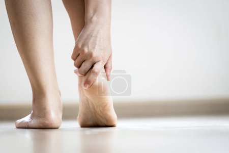 Femme asiatique tenant le talon avec sa main, symptôme de Fasciite plantaire, problème de tendon d'achilles souffrent de tendinite d'achilles, douleur et raideur dans les muscles et les ligaments de la jambe, pieds blessés en marchant